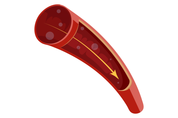Human Artery Graphics: A Publisher's Review